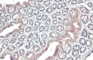 Anti-GSPT1 antibody used in IHC (Paraffin sections) (IHC-P). GTX105475