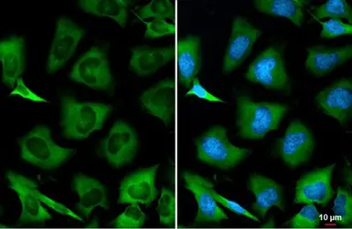 Anti-GSPT1 antibody used in Immunocytochemistry/ Immunofluorescence (ICC/IF). GTX105475