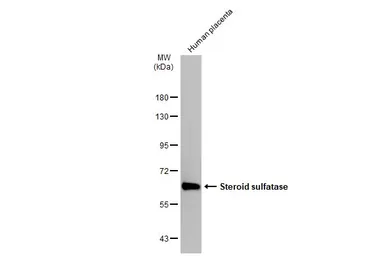 Anti-Steroid sulfatase antibody [N1C3] used in Western Blot (WB). GTX105498