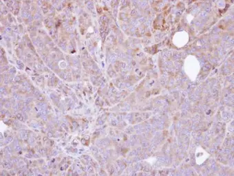 Anti-Steroid sulfatase antibody [N1C3] used in IHC (Paraffin sections) (IHC-P). GTX105498
