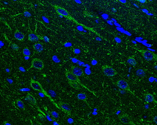 Anti-NAGLU antibody used in IHC (Paraffin sections) (IHC-P). GTX105504