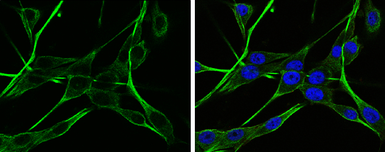 Anti-NAGLU antibody used in Immunocytochemistry/ Immunofluorescence (ICC/IF). GTX105504