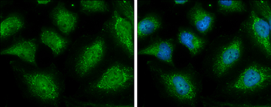 Anti-NAGLU antibody used in Immunocytochemistry/ Immunofluorescence (ICC/IF). GTX105504