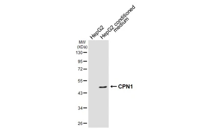 Anti-CPN1 antibody [N1C3] used in Western Blot (WB). GTX105515