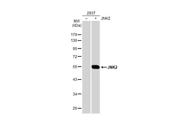 Anti-JNK2 antibody [N1C3] used in Western Blot (WB). GTX105523
