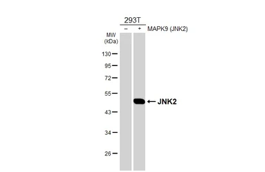 Anti-JNK2 antibody [N1C3] used in Western Blot (WB). GTX105523