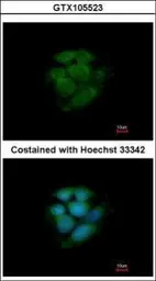 Anti-JNK2 antibody [N1C3] used in Immunocytochemistry/ Immunofluorescence (ICC/IF). GTX105523