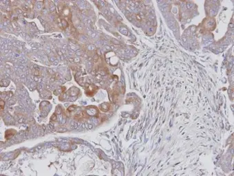 Anti-JNK2 antibody [N1C3] used in IHC (Paraffin sections) (IHC-P). GTX105523