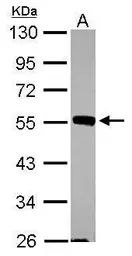 Anti-JNK2 antibody [N1C3] used in Western Blot (WB). GTX105523