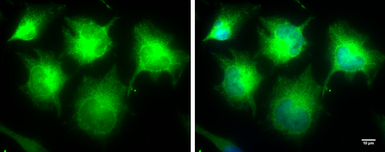 Anti-IKK epsilon antibody [N2C3] used in Immunocytochemistry/ Immunofluorescence (ICC/IF). GTX105547