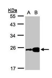 Anti-ILBP antibody used in Western Blot (WB). GTX105556