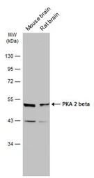 Anti-PKA 2 beta antibody used in Western Blot (WB). GTX105558