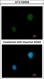 Anti-PKA 2 beta antibody used in Immunocytochemistry/ Immunofluorescence (ICC/IF). GTX105558