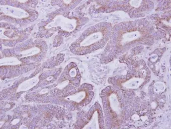 Anti-PKA 2 beta antibody used in IHC (Paraffin sections) (IHC-P). GTX105558