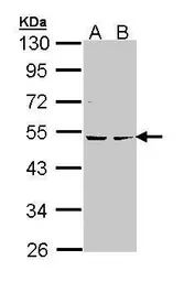Anti-PKA 2 beta antibody used in Western Blot (WB). GTX105558