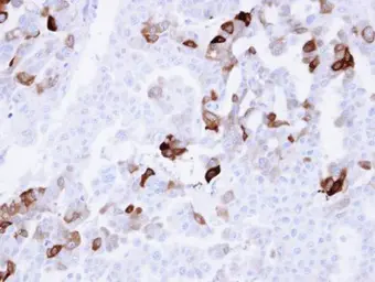 Anti-Carbonic Anhydrase II antibody [N1C3] used in IHC (Paraffin sections) (IHC-P). GTX105562