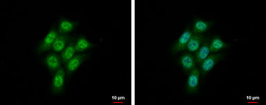 Anti-CMPK1 antibody [N1C3] used in Immunocytochemistry/ Immunofluorescence (ICC/IF). GTX105566