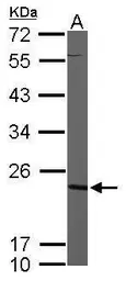 Anti-CMPK1 antibody [N1C3] used in Western Blot (WB). GTX105566