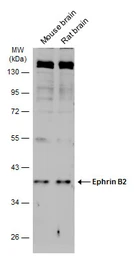 Anti-Ephrin B2 antibody [N1C1] used in Western Blot (WB). GTX105582