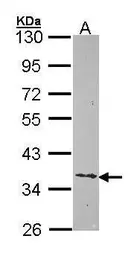 Anti-Ephrin B2 antibody [N1C1] used in Western Blot (WB). GTX105582