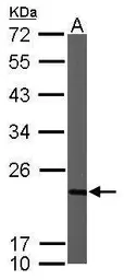 Anti-NDUFB9 antibody used in Western Blot (WB). GTX105590