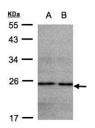 Anti-NDUFB9 antibody used in Western Blot (WB). GTX105590