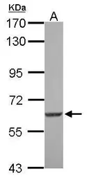 Anti-SGK3 antibody [N1N3] used in Western Blot (WB). GTX105604