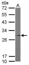 Anti-FKBP25 antibody [N1C3] used in Western Blot (WB). GTX105608