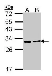Anti-FKBP25 antibody [N1C3] used in Western Blot (WB). GTX105608