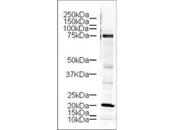 Anti-LIMK1 antibody used in Western Blot (WB). GTX10561