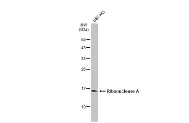 Anti-Ribonuclease A antibody used in Western Blot (WB). GTX105623