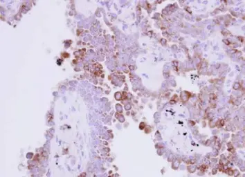 Anti-Ribonuclease A antibody used in IHC (Paraffin sections) (IHC-P). GTX105623