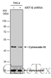 Anti-Cytokeratin 18 antibody [N2C2], Internal used in Western Blot (WB). GTX105624