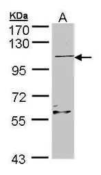 Anti-RGL2 antibody [N1N3] used in Western Blot (WB). GTX105632