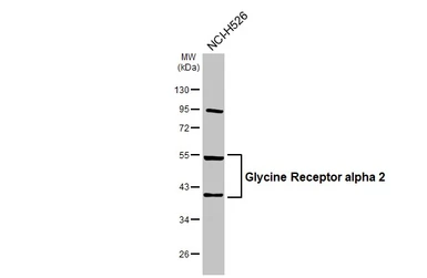 Anti-Glycine Receptor alpha 2 antibody used in Western Blot (WB). GTX105634