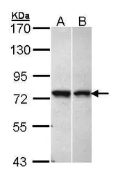 Anti-C11orf2 antibody [C1C3] used in Western Blot (WB). GTX105644