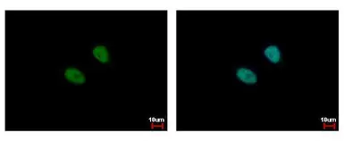 Anti-MSL3L1 antibody used in Immunocytochemistry/ Immunofluorescence (ICC/IF). GTX105652