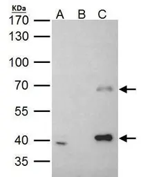 Anti-MSL3L1 antibody used in Immunoprecipitation (IP). GTX105652