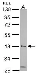 Anti-MSL3L1 antibody used in Western Blot (WB). GTX105652