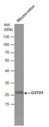 Anti-GSTO1 antibody [N1C3] used in Western Blot (WB). GTX105655