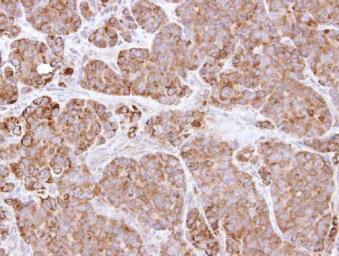 Anti-Bcl-X antibody used in IHC (Paraffin sections) (IHC-P). GTX105661