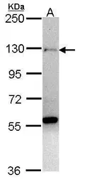 Anti-ZNF574 antibody used in Western Blot (WB). GTX105663