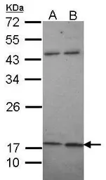 Anti-KCNMB1 antibody [N1C3] used in Western Blot (WB). GTX105666