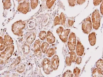 Anti-Cathepsin O antibody [N1C3] used in IHC (Paraffin sections) (IHC-P). GTX105671