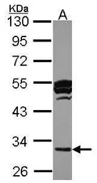 Anti-Cathepsin O antibody [N1C3] used in Western Blot (WB). GTX105671