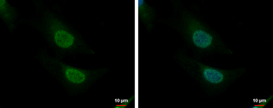 Anti-CNOT8 antibody used in Immunocytochemistry/ Immunofluorescence (ICC/IF). GTX105674