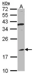 Anti-Interferon alpha 8 antibody [N1C3] used in Western Blot (WB). GTX105681