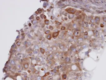 Anti-GPX7 antibody [N1C3] used in IHC (Paraffin sections) (IHC-P). GTX105683