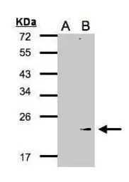 Anti-GPX7 antibody [N1C3] used in Western Blot (WB). GTX105683