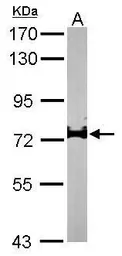 Anti-IL17 Receptor D antibody [N3C2], Internal used in Western Blot (WB). GTX105688